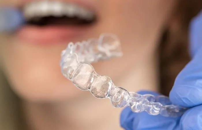 Orthodontic Treatment is used to improve the appearance, position, function of crooked, abnormally arranged teeth, and the development of the jaw.