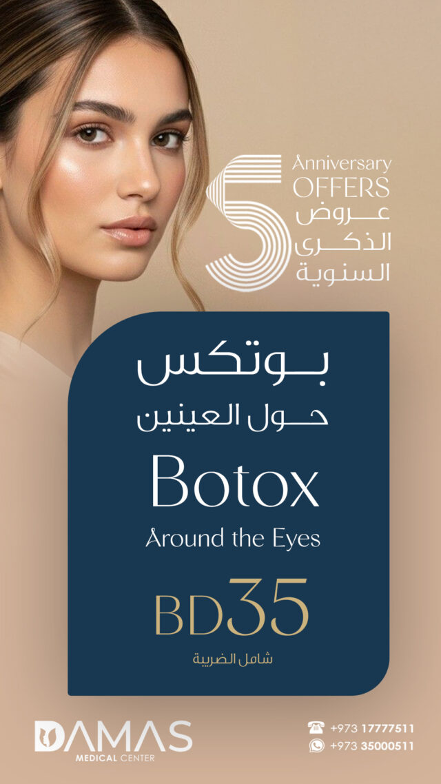 Botox-Around-the-Eyes